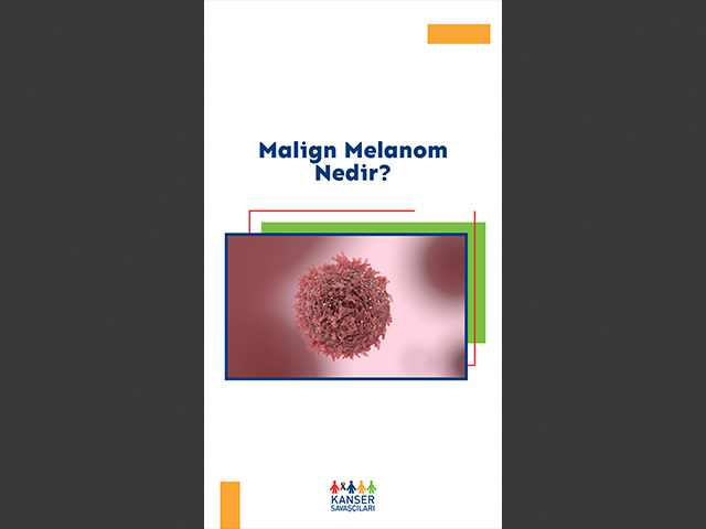 Malign Melanom Nedir?