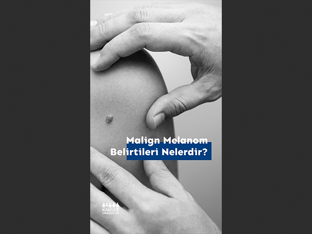 Maling Melanomun Yaygın Belirtileri